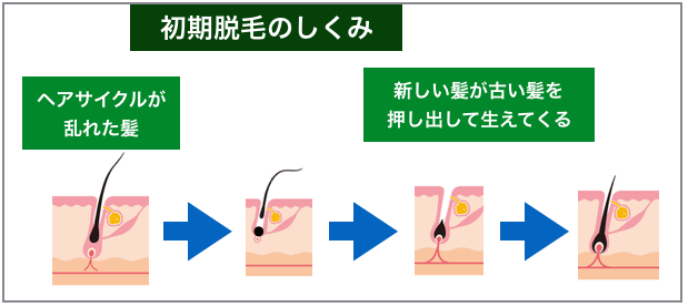 プロが教えるベルタ育毛剤の2つの効果と上手に使う全ポイント