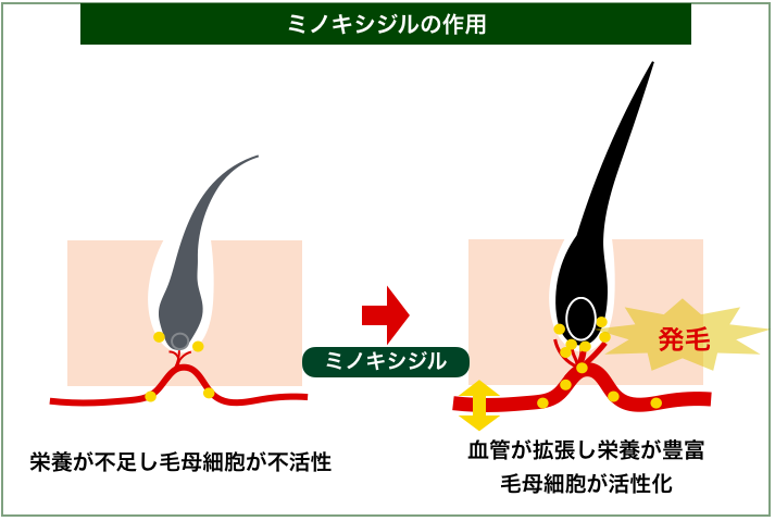 騙されるな 34種使ってわかった市販の育毛剤おすすめ10選
