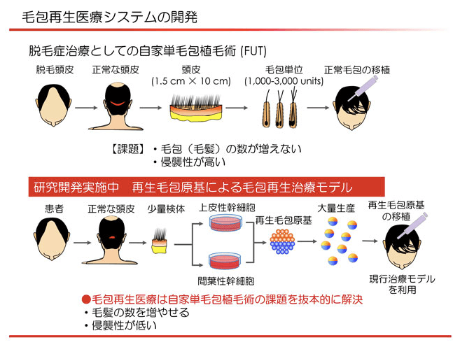 京セラの毛髪再生治療技術のイメージ