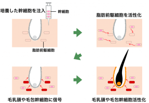 「髪の毛ありますか？」2026年、薄毛治療の常識を覆す「自己細胞培養シート」の実力と、問われる日本のAGA治療最前線
