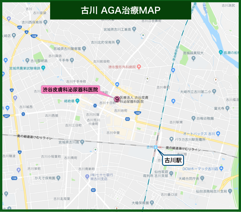 宮城AGA治療MAP