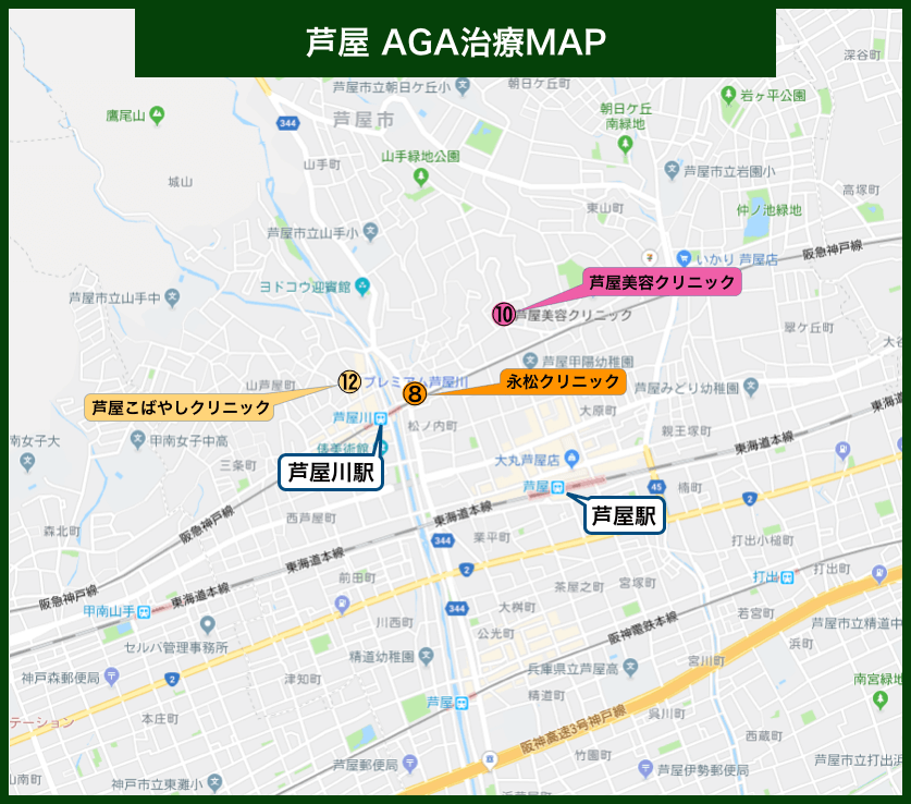 芦屋AGA治療MAP