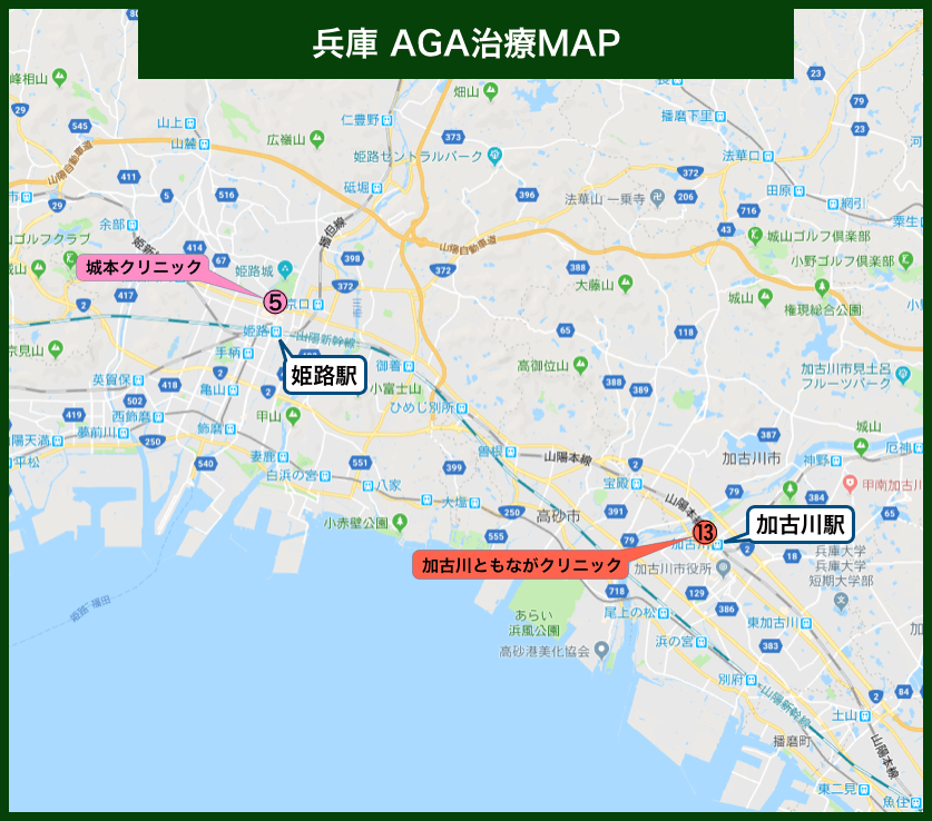 兵庫AGA治療MAP