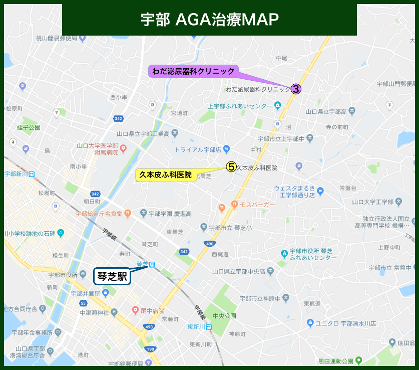 宇部AGA治療MAP