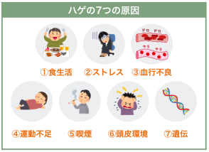20代がはげる7つの原因と対策まとめ【薄毛・若ハゲの完全マニュアル】医師監修