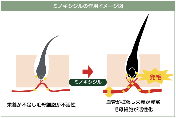 ミノキシジルの作用イメージ図