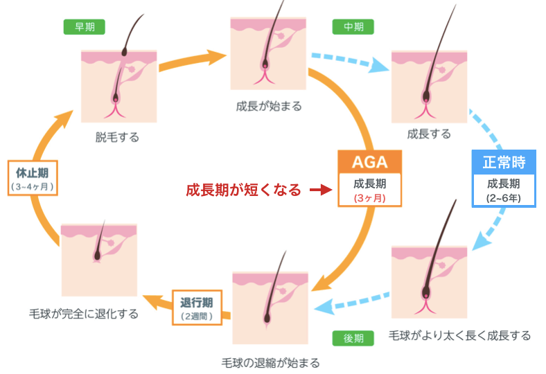 プロが教える薄毛対策 スカスカな髪を対策するための全知識
