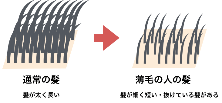 簡単に髪にボリュームを出す方法5選と根本的な対策まとめ