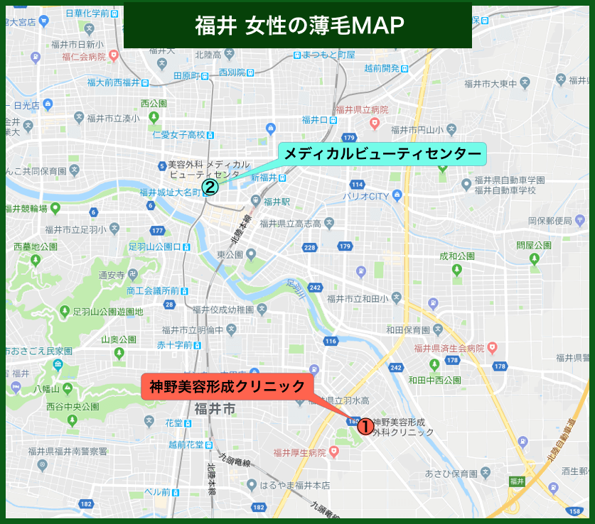 福井女性の薄毛治療MAP