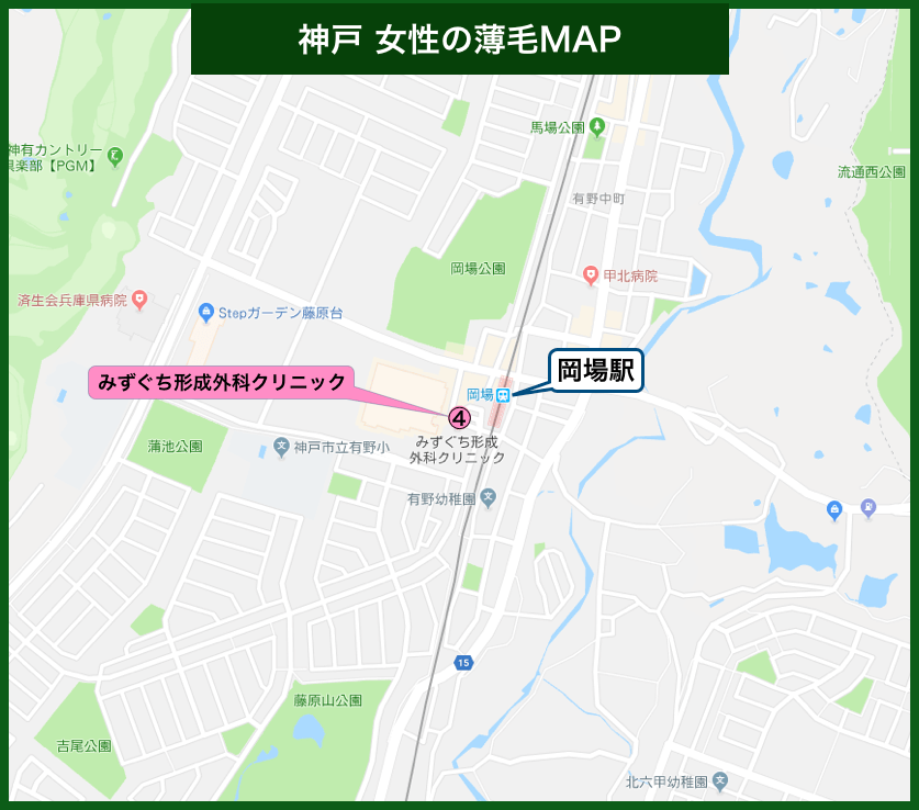 神戸女性の薄毛MAP
