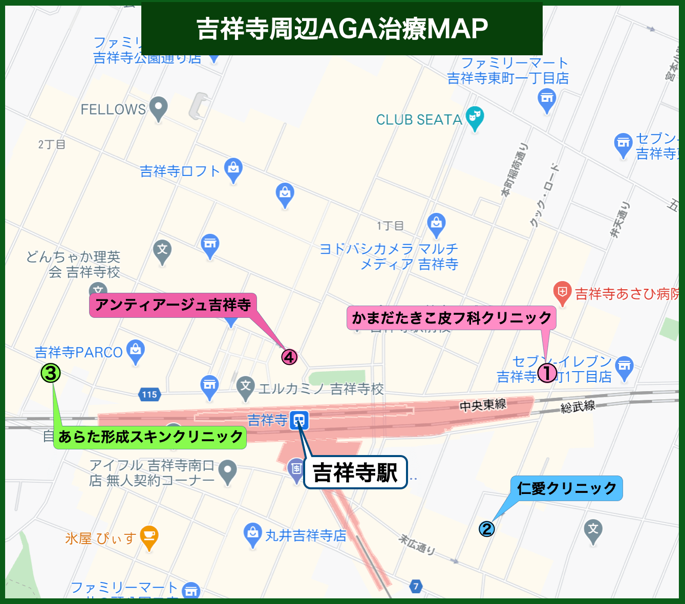吉祥寺周辺AGA治療MAP