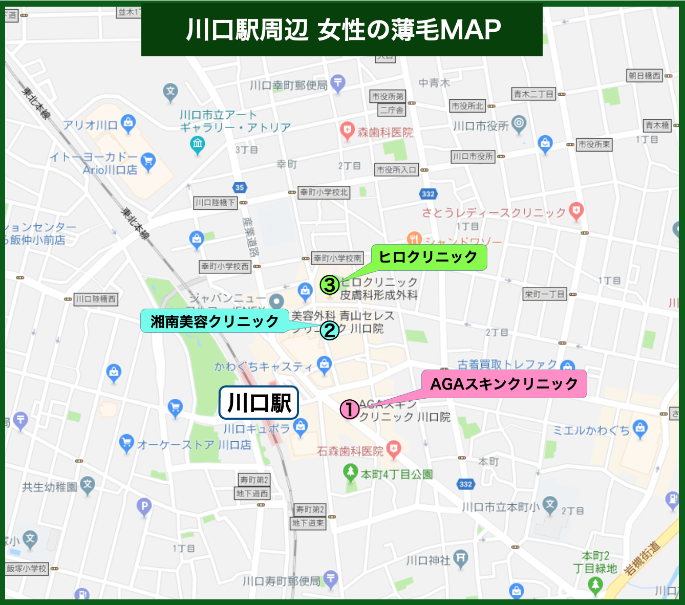 川口駅周辺 女性の薄毛MAP