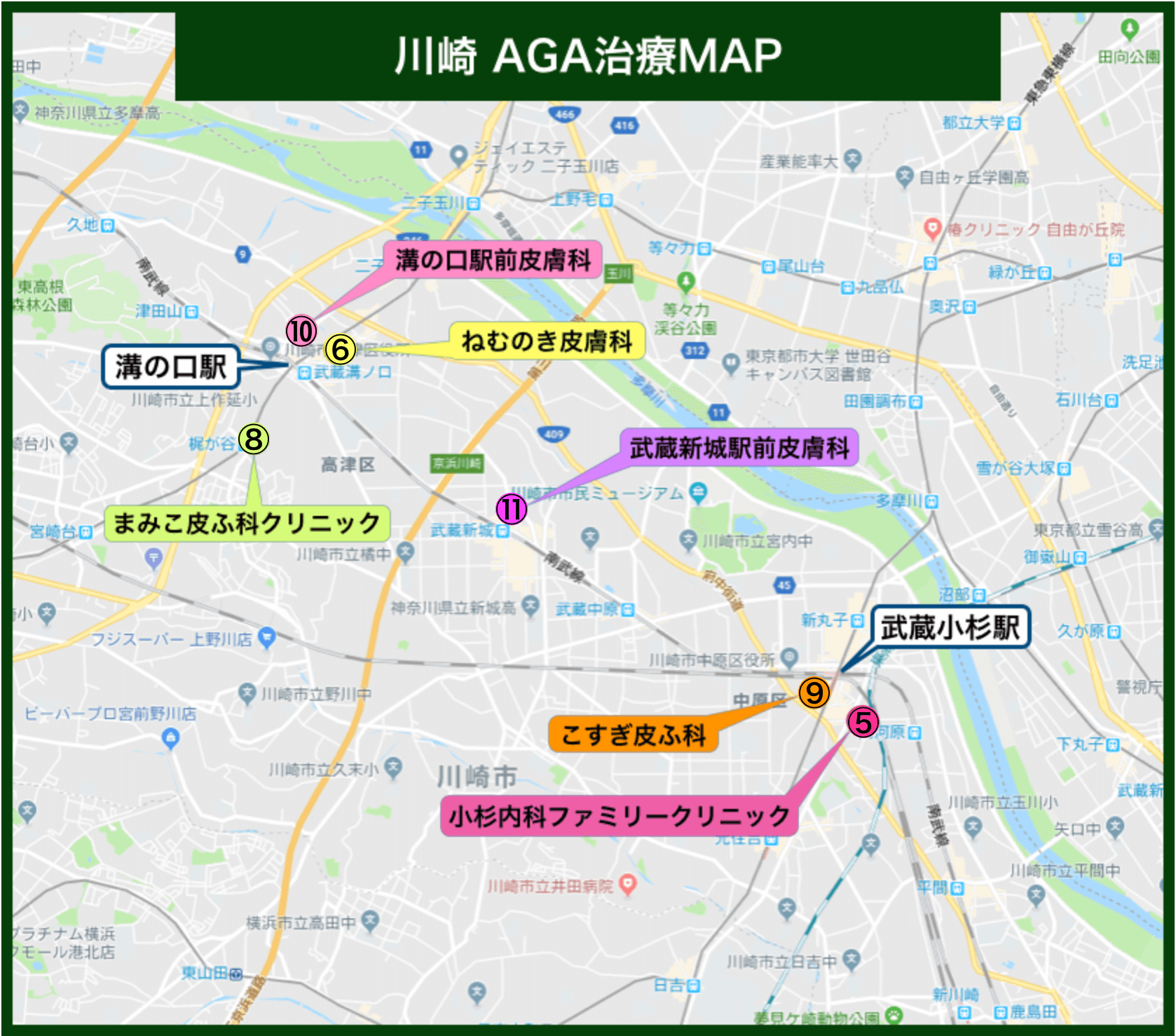 川崎AGA治療MAP