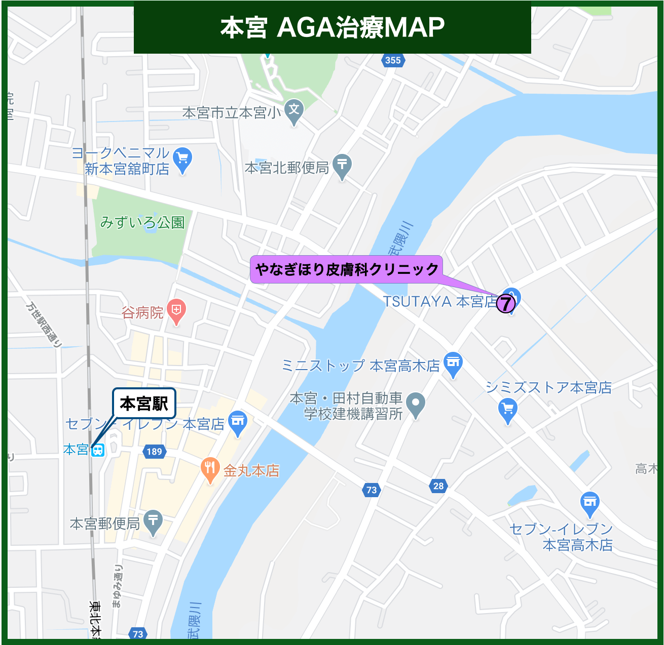 本宮 AGA治療MAP