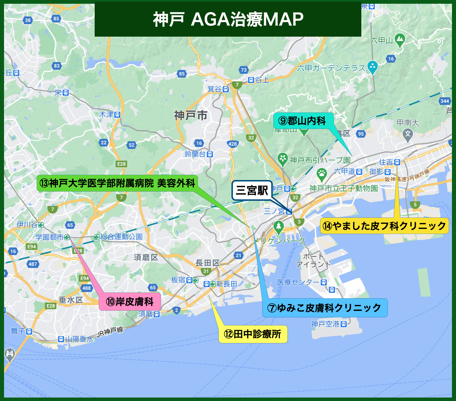 神戸AGA治療MAP