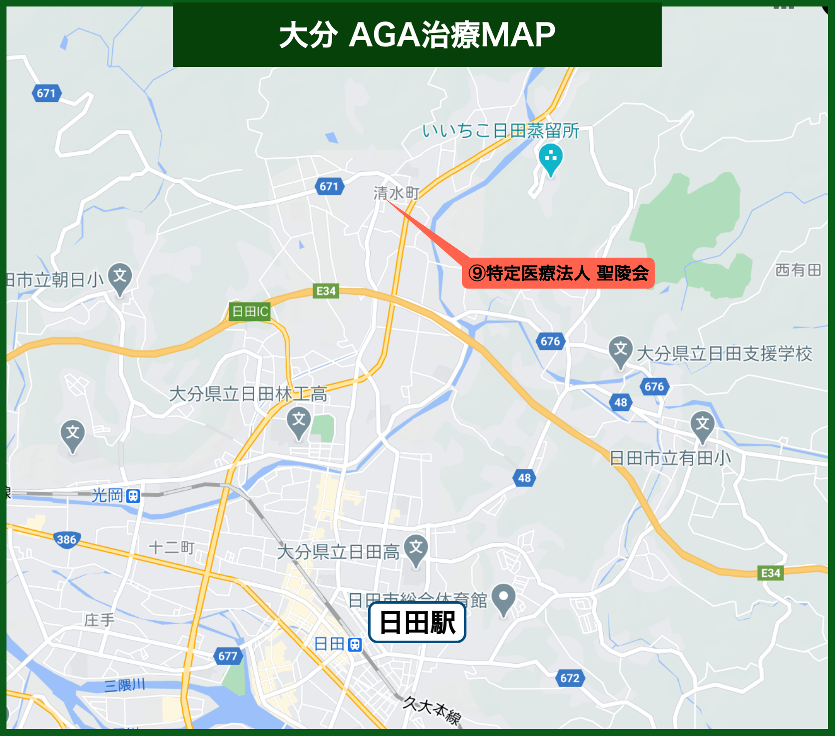 大分AGA治療MAP