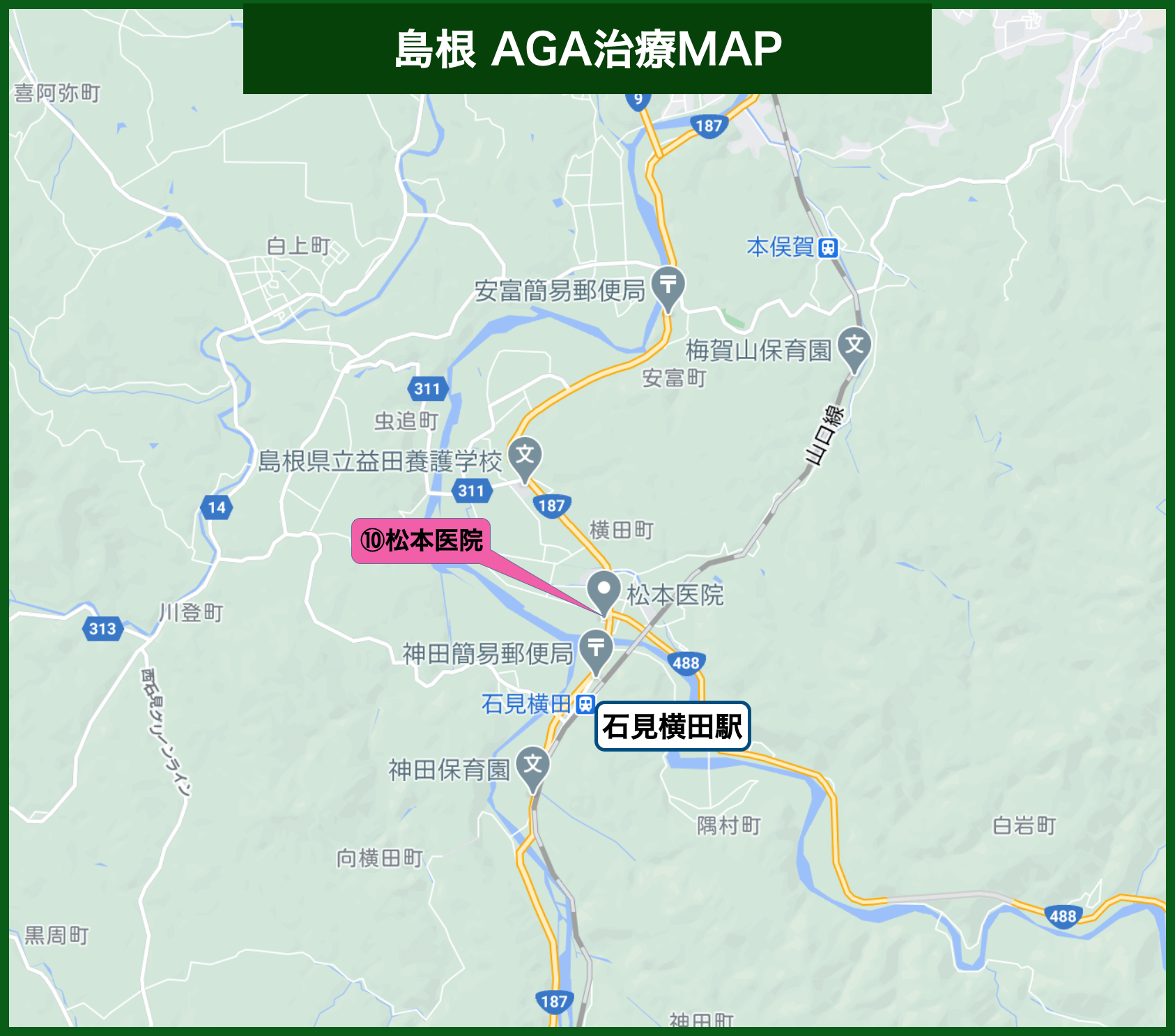 松江AGA治療MAP