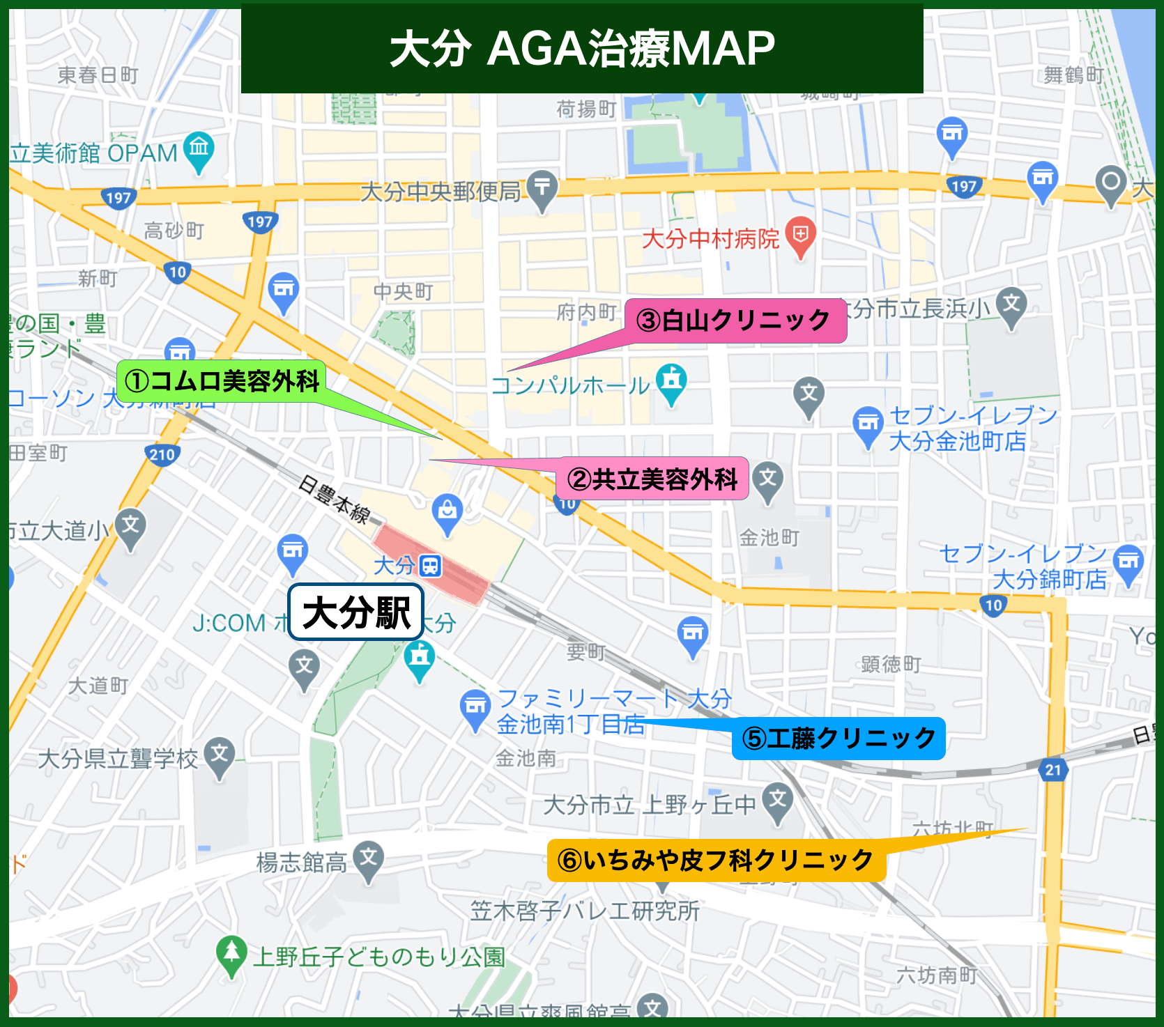 大分AGA治療MAP