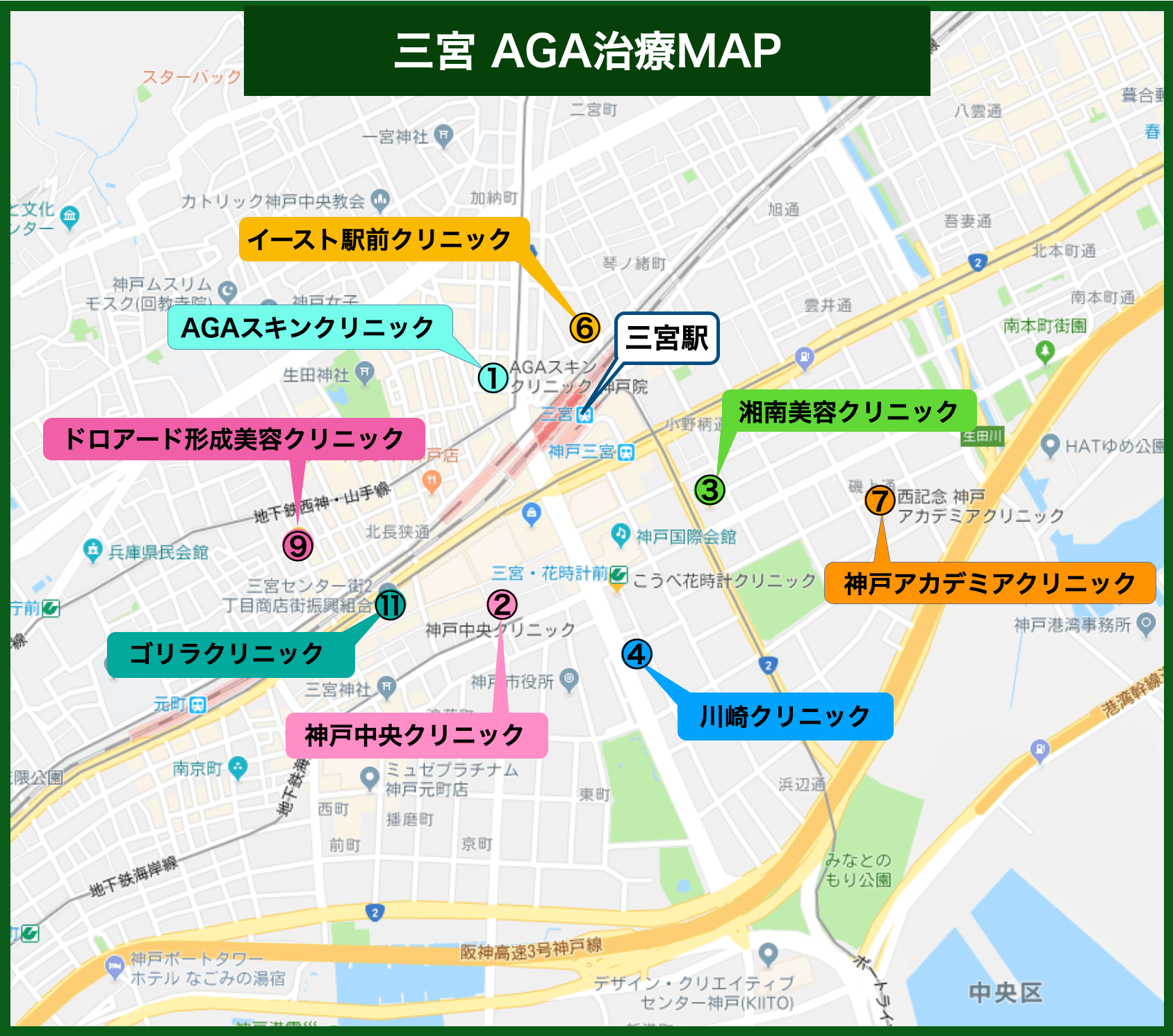 三宮AGA治療MAP
