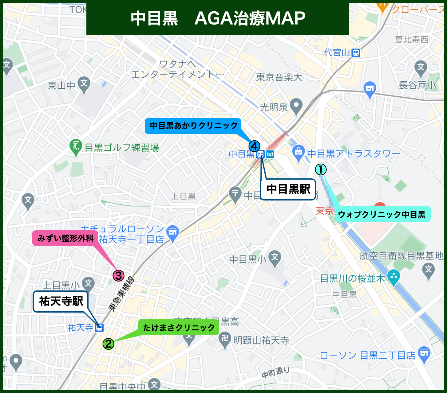 中目黒AGA治療MAP