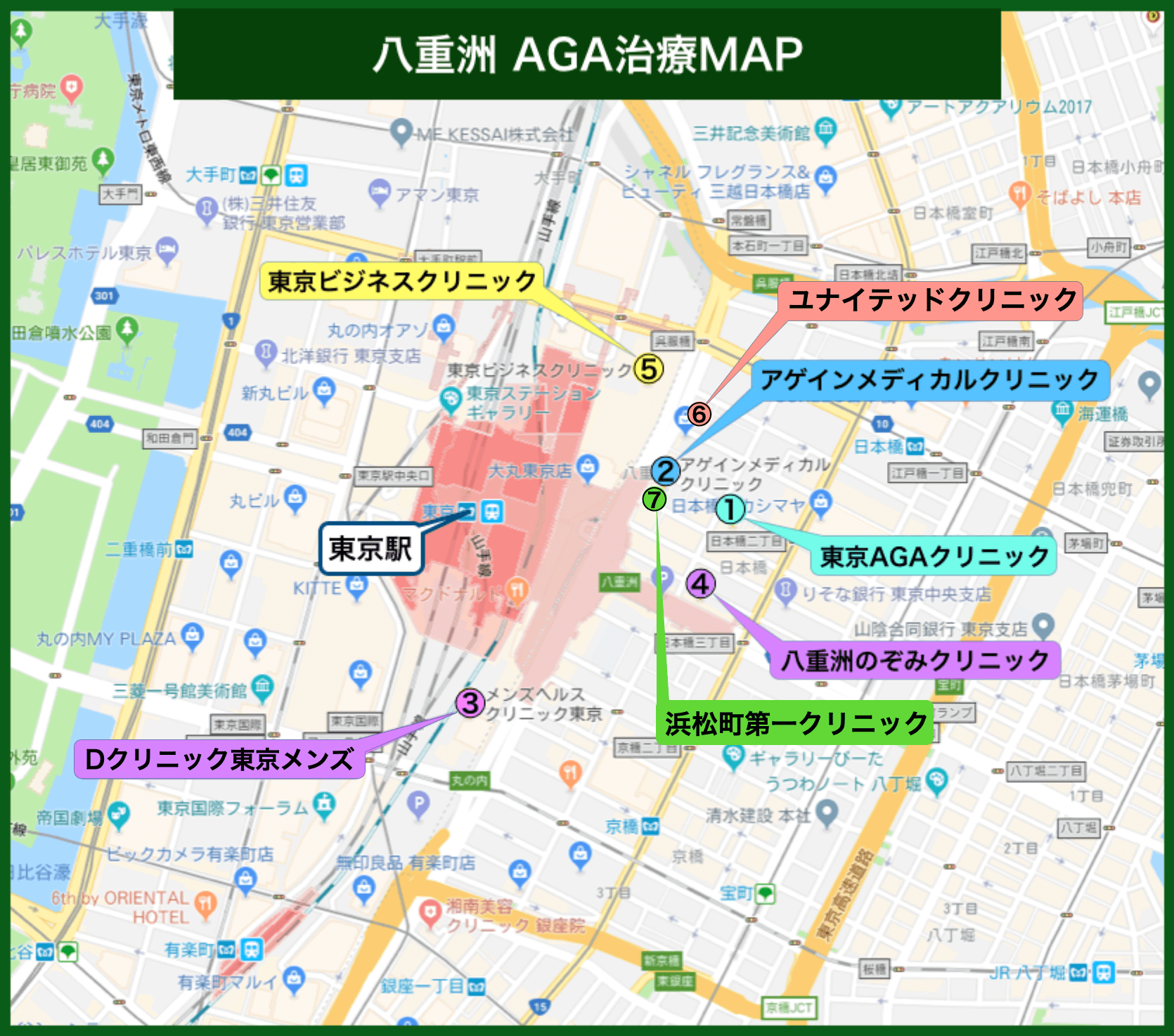 八重洲AGA治療MAP