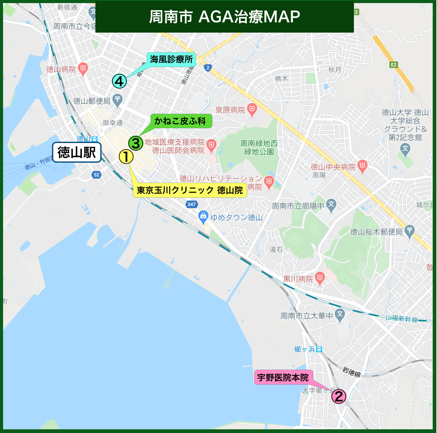 周南市 AGA治療MAP