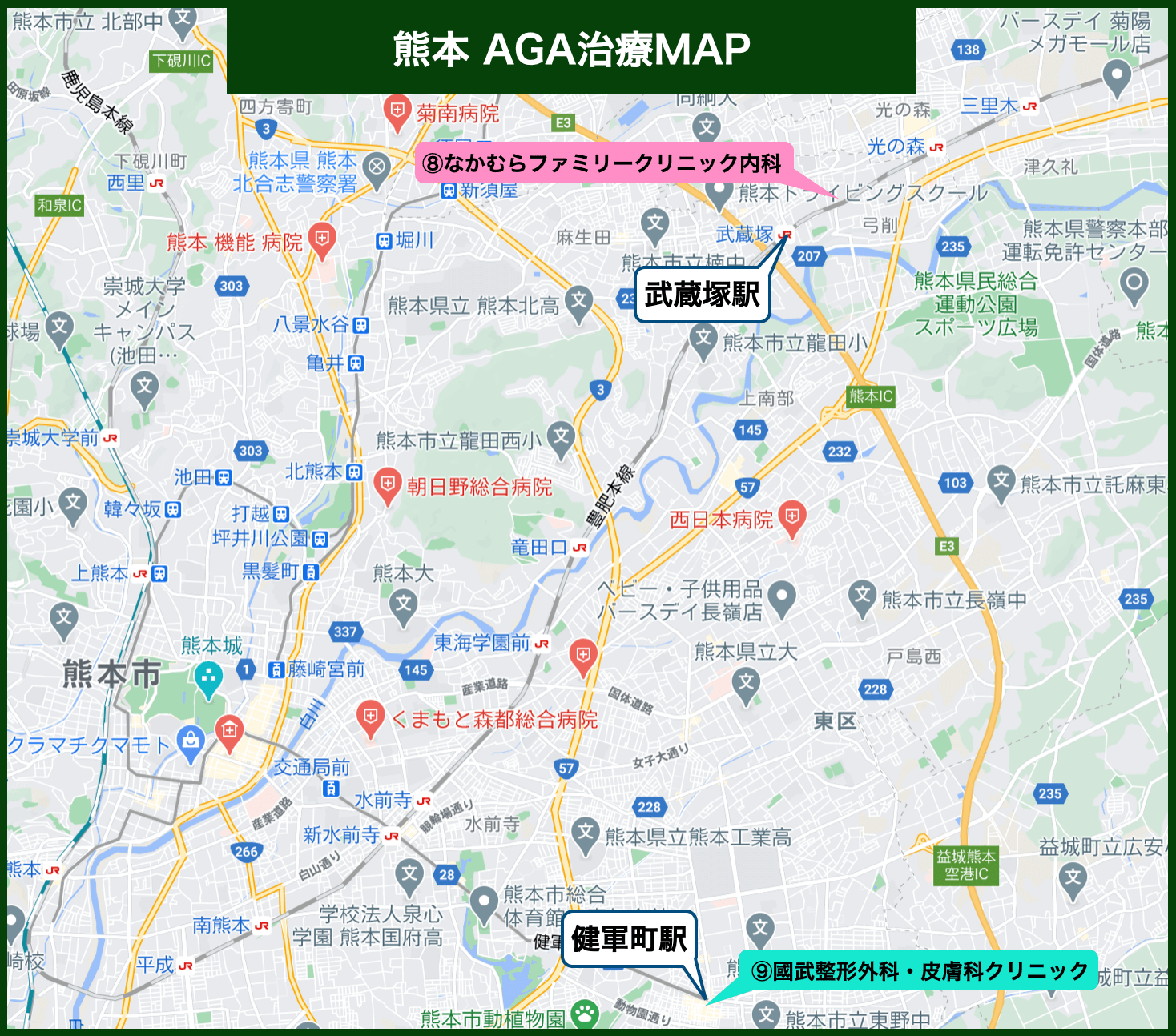 熊本 AGA治療MAP
