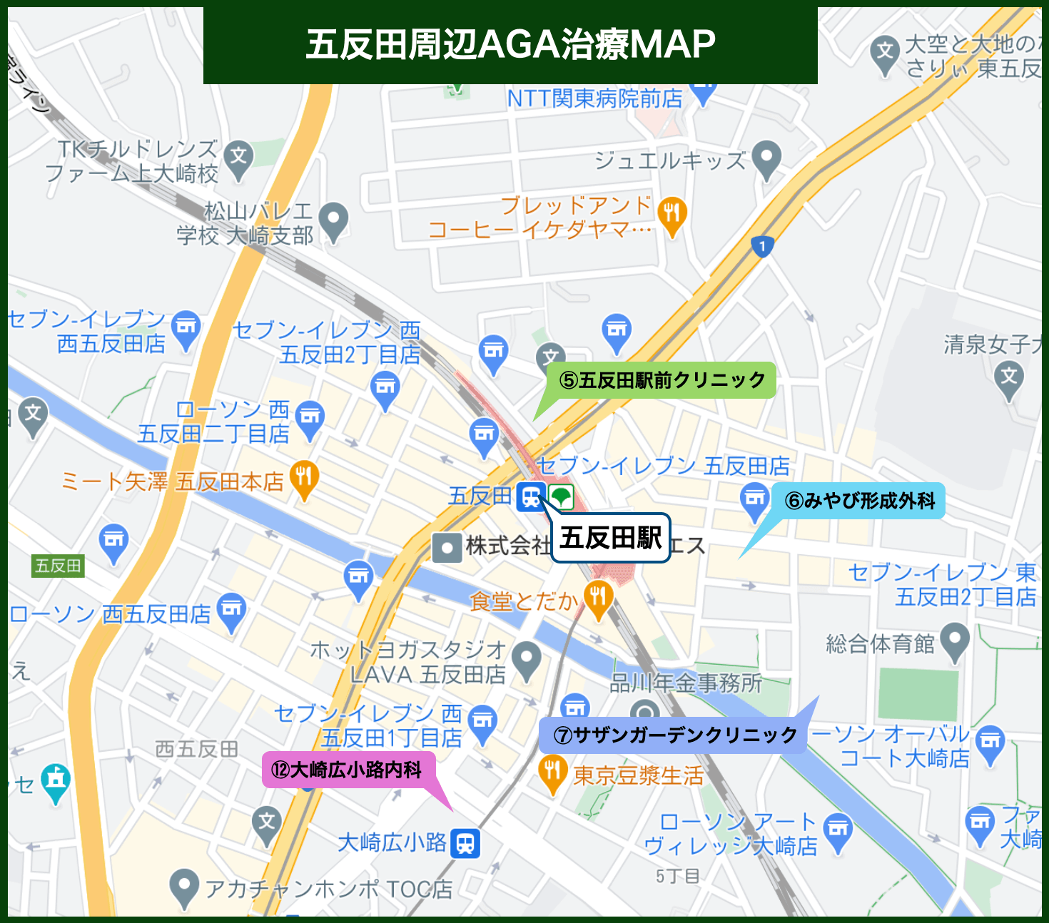 五反田周辺AGA治療MAP