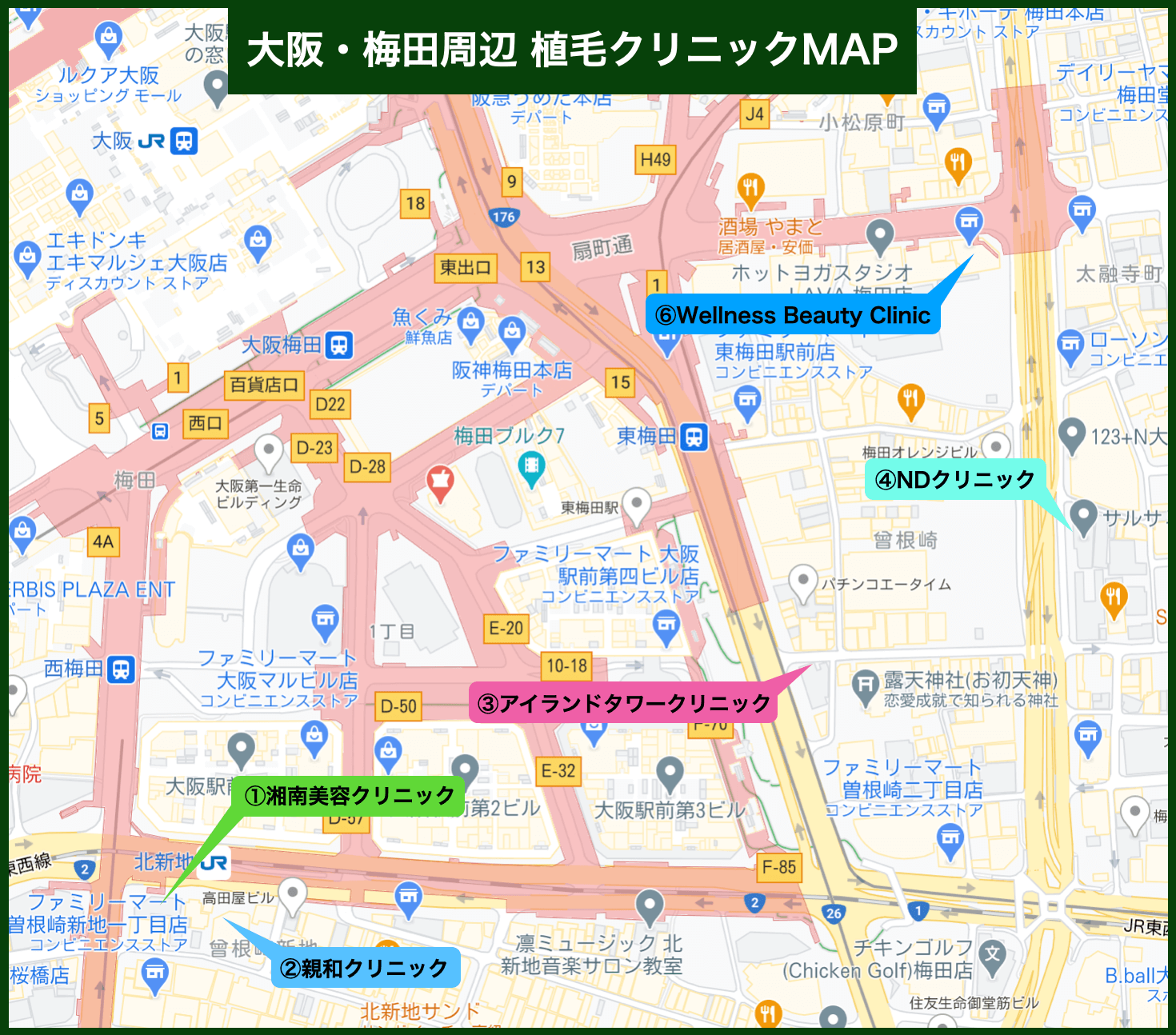 大阪で植毛治療ができるクリニックの選び方とおすすめ2選