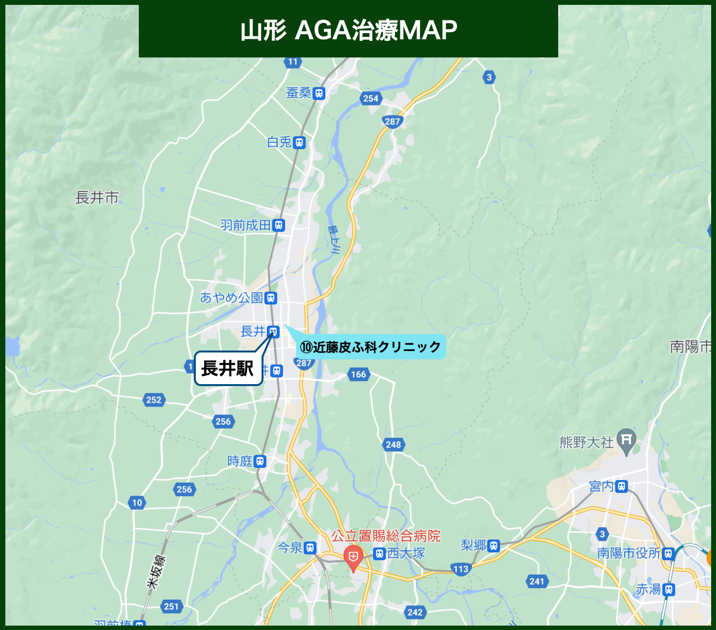 山形 AGA治療MAP