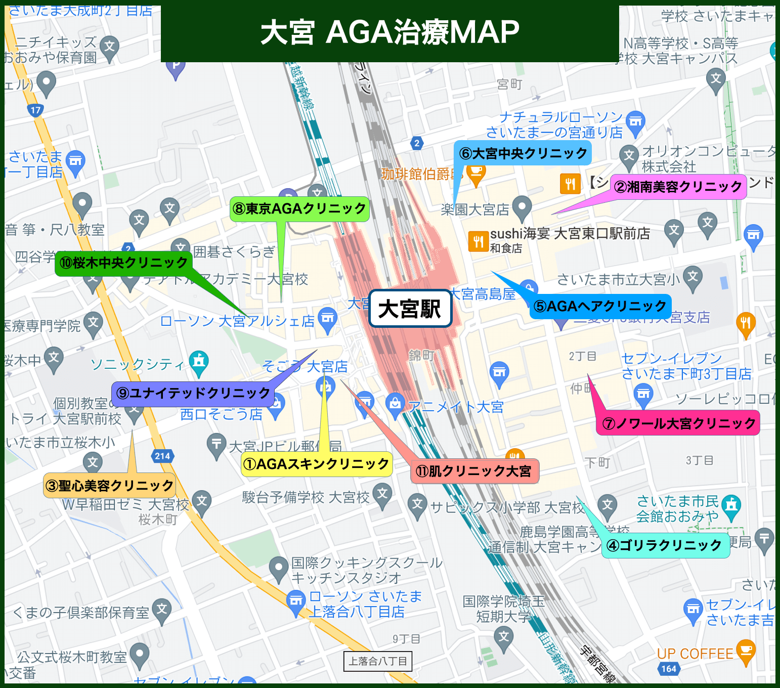 大宮AGA治療MAP