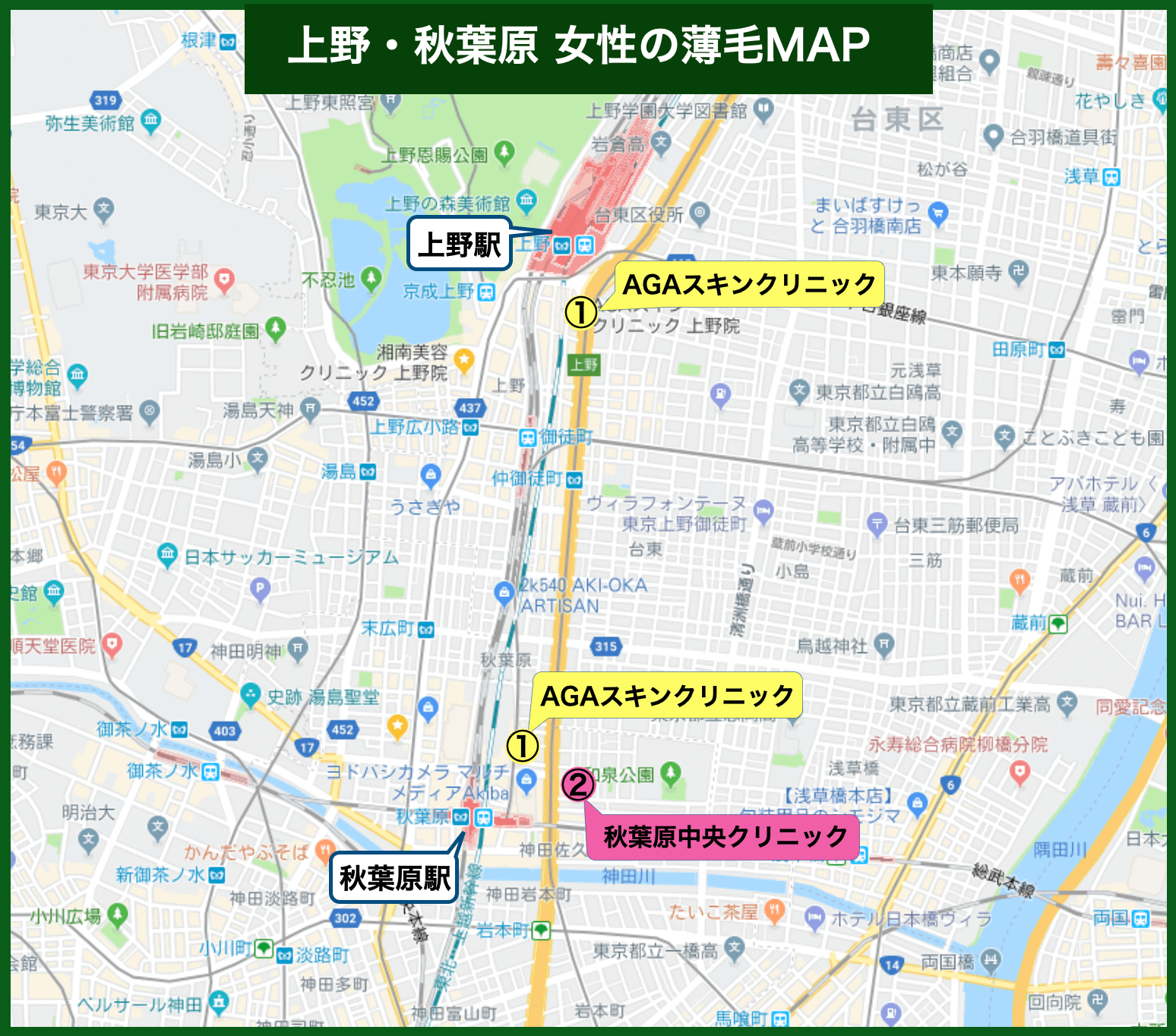 上野・秋葉原女性の薄毛MAP