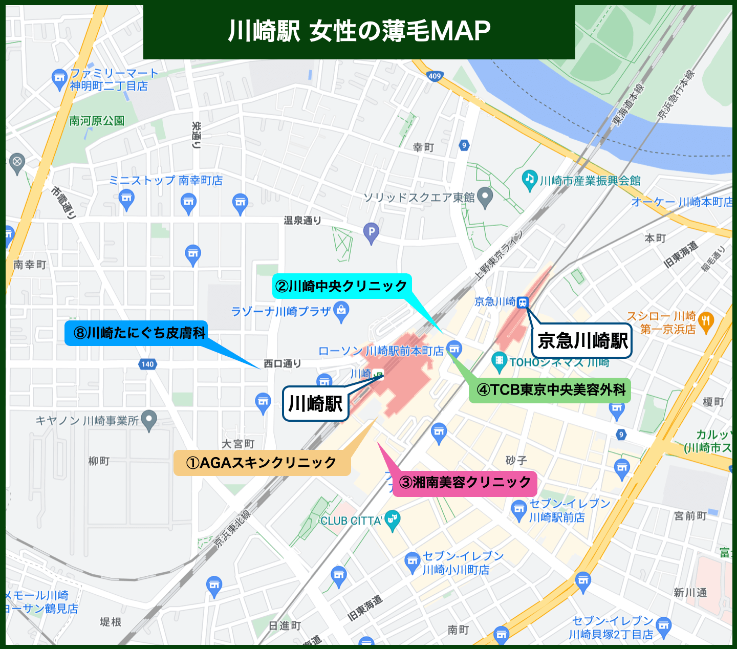 川崎駅女性の薄毛MAP