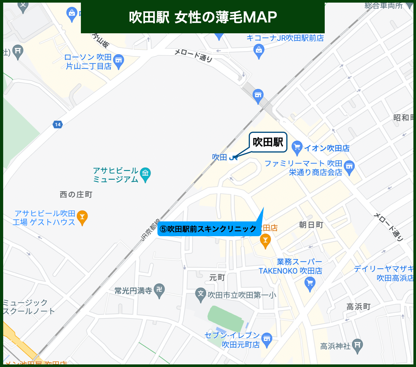 吹田駅女性の薄毛MAP