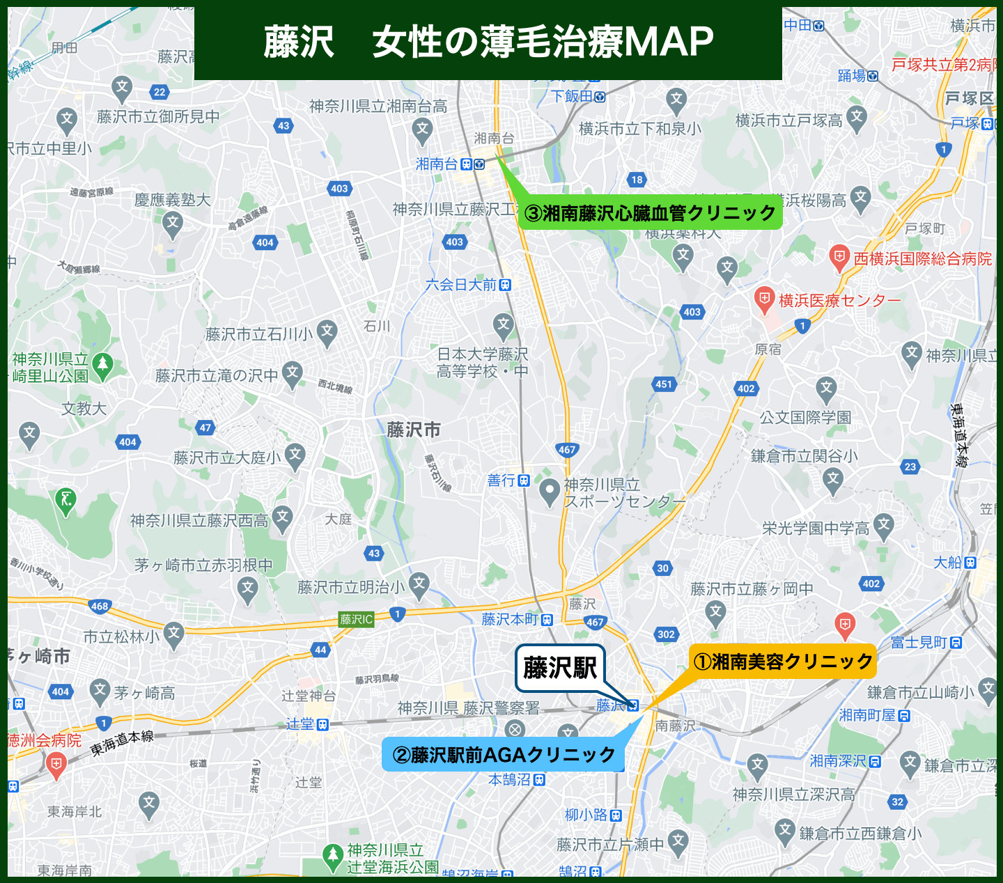 藤沢市女性の薄毛MAP