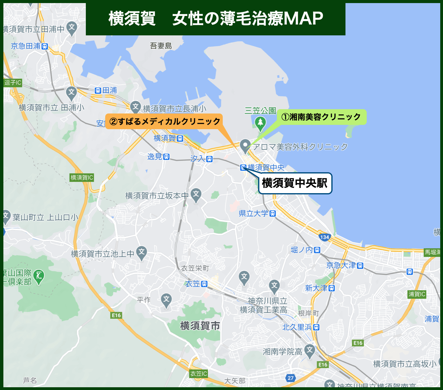 横須賀市女性の薄毛MAP
