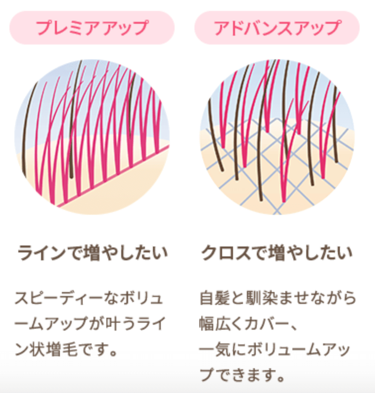 レディスアデランス増毛