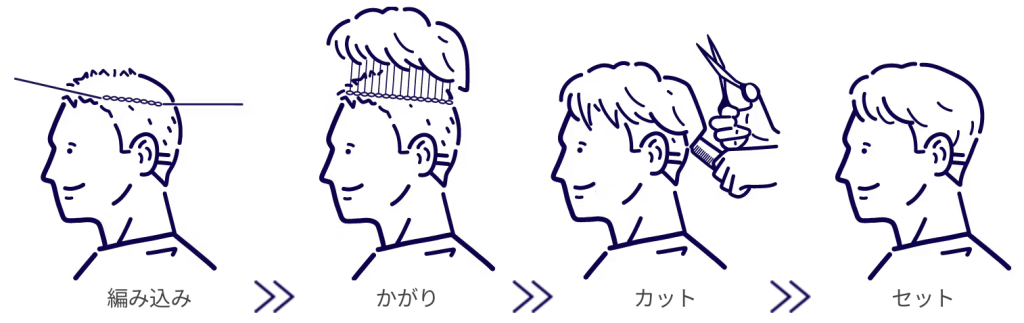 スヴェンソン式増毛