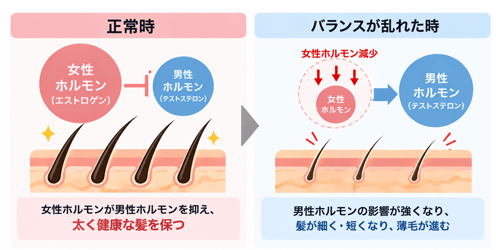 女性の薄毛の原因とメカニズム