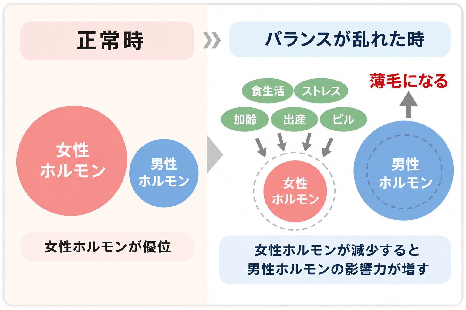 女性男性型脱毛症(FAGA)の仕組み